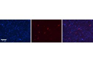 Rabbit Anti-S100A8 Antibody Catalog Number: ARP61367_P050 Formalin Fixed Paraffin Embedded Tissue: Human Heart Tissue Observed Staining: Cytoplasm in endothelial cells in capillaries Primary Antibody Concentration: N/A Other Working Concentrations: 1:600 Secondary Antibody: Donkey anti-Rabbit-Cy3 Secondary Antibody Concentration: 1:200 Magnification: 20X Exposure Time: 0. (S100A8 Antikörper  (Middle Region))
