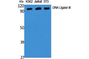 Western Blot (WB) analysis of specific cells using DNA Ligase III Polyclonal Antibody. (LIG3 Antikörper  (Internal Region))