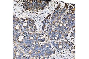 IHC analysis of PMPCA/INPP5 using anti-PMPCA/INPP5 antibody (ABIN7602722). (PMPCA Antikörper  (AA 99-525))