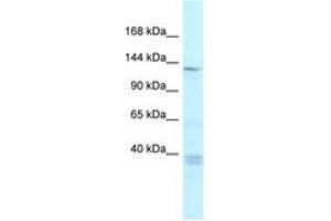 Image no. 1 for anti-Tankyrase, TRF1-Interacting Ankyrin-Related ADP-Ribose Polymerase (TNKS) (AA 448-497) antibody (ABIN6747515) (TNKS Antikörper  (AA 448-497))