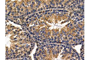 ABIN6257398 and ABIN6276108 at 1/100 staining Mouse testis tissue by IHC-P. (Rho-related GTP-binding protein Antikörper  (C-Term))