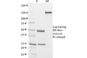 SDS-PAGE (SDS) image for anti-Podocalyxin-Like (PODXL) (Extracellular Domain) antibody (ABIN6940326)