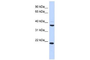 Western Blotting (WB) image for anti-Transmembrane Protein 74 (TMEM74) antibody (ABIN2459633) (TMEM74 Antikörper)