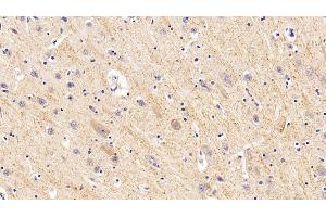 Immunohistochemistry (IHC) image for anti-Galactosidase, beta 1 (GLB1) (AA 68-219) antibody (ABIN7431287)