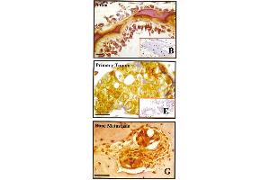 Immunohistochemistry image of BSP staining in paraffn sections of human tissues. (BSP Antikörper)