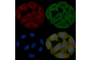 ABIN6258004 and ABIN6275034 staining Hela cells(30 min of UV treatment) by IF/ICC. (CD55 Antikörper  (Internal Region))