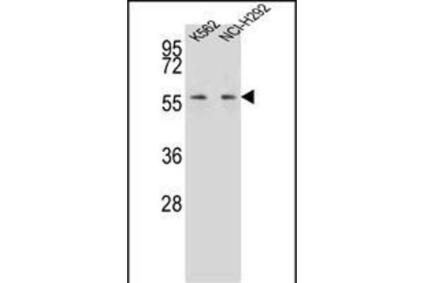 MPP3 antibody  (C-Term)