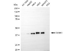 anti-Calcium/calmodulin-Dependent Protein Kinase I (CAMK1) antibody