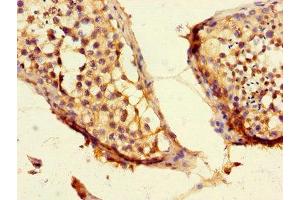 Immunohistochemistry of paraffin-embedded human testis tissue using ABIN7147399 at dilution of 1:100 (CEP192 Antikörper  (AA 447-711))