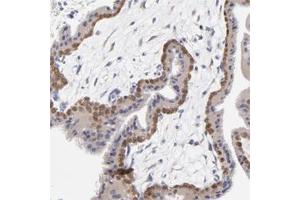 Immunohistochemical staining of human placenta with DUSP9 polyclonal antibody  shows moderate cytoplasmic and nuclear positivity in trophoblastic cells.
