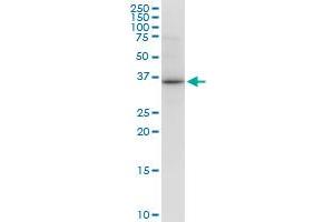 VAX1 monoclonal antibody (M03), clone 2F4. (VAX1 Antikörper  (AA 1-100))