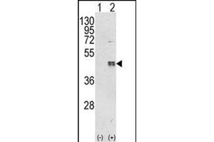 Western blot analysis of CEBPB (arrow) using rabbit polyclonal CEBPB Antibody (C-term) (ABIN652248 and ABIN2841040). (CEBPB Antikörper  (C-Term))