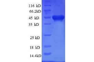 SDS-PAGE (SDS) image for Kinesin Family Member 1C (KIF1C) (AA 1-272) protein (His-SUMO Tag) (ABIN4975038) (KIF1C Protein (AA 1-272) (His-SUMO Tag))