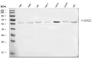 Western blot analysis of USP22 using anti-USP22 antibody (ABIN7603248).