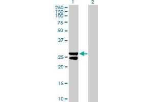 Western Blot analysis of MMAB expression in transfected 293T cell line by MMAB MaxPab polyclonal antibody. (MMAB Antikörper  (AA 1-250))