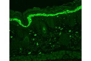 Immunohistochemistry analysis using Mouse Anti-Phosphotyrosine Monoclonal Antibody, Clone G104 . (Phosphotyrosine Antikörper  (Biotin))