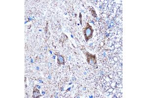 Immunohistochemistry of paraffin-embedded Mouse spinal cord using CTGF Rabbit pAb (ABIN6127717, ABIN6139188, ABIN6139191 and ABIN6215222) at dilution of 1:100 (40x lens). (CTGF Antikörper  (AA 27-349))