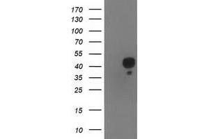 Western Blotting (WB) image for anti-NudE Nuclear Distribution E Homolog (A. Nidulans)-Like 1 (NDEL1) antibody (ABIN1499855) (NDEL1 Antikörper)
