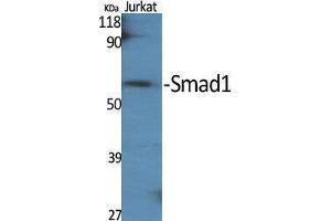 Western Blotting (WB) image for anti-SMAD, Mothers Against DPP Homolog 1 (SMAD1) (Ser789) antibody (ABIN3180317) (SMAD1 Antikörper  (Ser789))