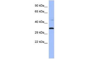 WB Suggested Anti-PYCR1  Antibody Titration: 0. (PYCR1 Antikörper  (Middle Region))