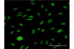 Immunofluorescence of monoclonal antibody to CMAS on HeLa cell. (CMAS Antikörper  (AA 164-263))