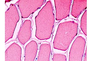 Anti-MB / Myoglobin antibody IHC staining of human skeletal muscle. (Myoglobin Antikörper)