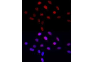 Immunofluorescence (IF) image for anti-Leo1, Paf1/RNA Polymerase II Complex Component, Homolog (S. Cerevisiae) (LEO1) antibody (ABIN6133790)