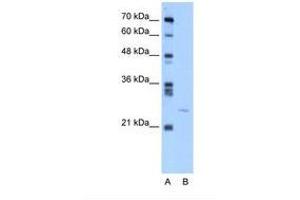 Image no. 1 for anti-YEATS Domain Containing 4 (C-Term) antibody (ABIN324207) (GAS41 Antikörper  (C-Term))