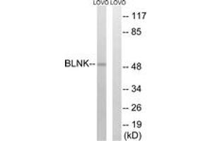 Western blot analysis of extracts from LOVO cells, treated with etoposide 25uM 24h, using BLNK (Ab-96) Antibody. (B-Cell Linker Antikörper  (AA 62-111))