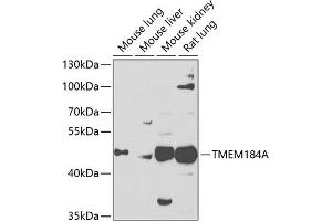 Western blot analysis of extracts of various cell lines, using TMEM184A antibody (ABIN6128873, ABIN6149260, ABIN6149261 and ABIN6223833) at 1:1000 dilution. (TMEM184A Antikörper  (AA 324-413))