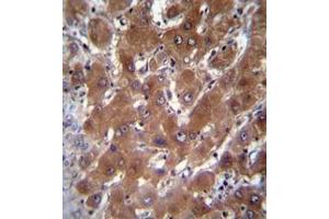 Immunohistochemistry analysis in formalin fixed and paraffin embedded human liver tissue reacted with Cytosolic beta-glucosidase Antibody (C-term) followed by peroxidase conjugation of the secondary antibody and DAB staining. (GBA3 Antikörper  (C-Term))