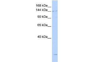 WB Suggested Anti-SMC4 Antibody Titration:  0. (SMC4 Antikörper  (N-Term))