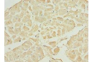 Immunohistochemistry of paraffin-embedded human heart tissue using ABIN7169200 at dilution of 1:100 (TNNI3K Antikörper  (AA 1-75))