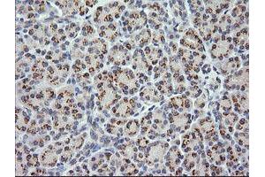 Image no. 1 for anti-Cancer/testis Antigen 1B (CTAG1B) antibody (ABIN1499891) (CTAG1B Antikörper)