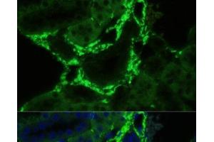 Immunofluorescence analysis of Mouse kidney using COL1A1 Polyclonal Antibody at dilution of 1:100. (COL1A1 Antikörper)