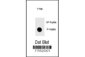 Dot blot analysis of phospho-MBP antibody. (MBP Antikörper  (pTyr203))