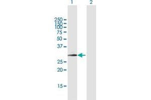 Western Blot analysis of SPINT2 expression in transfected 293T cell line by SPINT2 MaxPab polyclonal antibody. (SPINT2 Antikörper  (AA 1-252))