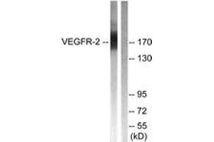Western blot analysis of extracts from HepG2 cells, treated with Na3VO4 0. (VEGFR2/CD309 Antikörper  (AA 1025-1074))