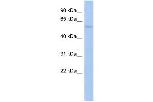 WB Suggested Anti-PTPN5 Antibody Titration:  0. (PTPN5 Antikörper  (Middle Region))