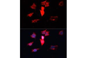 Immunofluorescence analysis of HeLa cells using C antibody (ABIN3021589, ABIN3021590, ABIN3021591 and ABIN6215299) at dilution of 1:100. (Calmodulin 3 Antikörper  (AA 1-100))