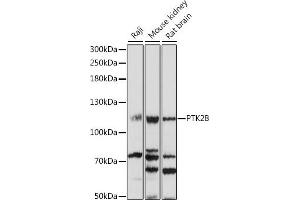 Western blot analysis of extracts of various cell lines, using PTK2B antibody (ABIN7269745) at 1:1000 dilution. (PTK2B Antikörper  (AA 1-100))
