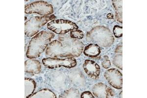 Immunohistochemical staining (Formalin-fixed paraffin-embedded sections) of human kidney with CA12 monoclonal antibody, clone CL0278  shows strong membranous immunoreactivity in renal tubules, but not glomeruli. (CA12 Antikörper)