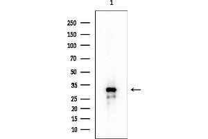 anti-Single-Stranded DNA Binding Protein 2 (SSBP2) (N-Term) antibody