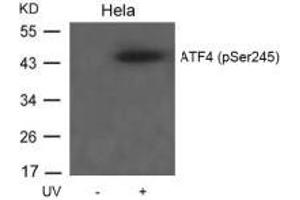 Western blot analysis of extracts from Hela cells untreated or treated with UV using ATF4(Phospho-Ser245) Antibody. (ATF4 Antikörper  (pSer245))