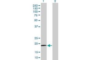 Western Blot analysis of RPS19 expression in transfected 293T cell line by RPS19 MaxPab polyclonal antibody. (RPS19 Antikörper  (AA 1-145))