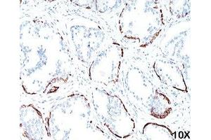 IHC staining of human prostate (10X) with HMW Cytokeratin antibody (34bE12).