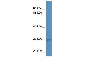 Western Blot showing F11R antibody used at a concentration of 1 ug/ml against Hela Cell Lysate (F11R Antikörper  (C-Term))