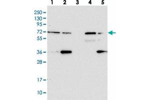 Western blot analysis of Lane 1: RT-4, Lane 2: U-251 MG, Lane 3: Human Plasma, Lane 4: Liver, Lane 5: Tonsil with ZNF609 polyclonal antibody  at 1:100-1:250 dilution. (ZNF609 Antikörper)