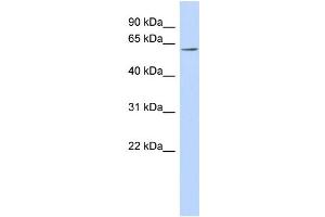 WB Suggested Anti-FLJ14803 Antibody Titration: 0. (TMEM209 Antikörper  (N-Term))