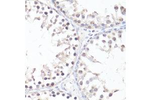 Immunohistochemistry of paraffin-embedded rat testis using P-MYC-T58 antibody (ABIN3019538, ABIN3019539, ABIN3019540 and ABIN6225454) at dilution of 1:100 (40x lens). (c-MYC Antikörper  (pThr58))